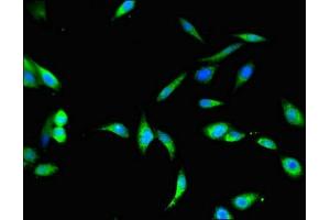 Immunofluorescent analysis of Hela cells using ABIN7168546 at dilution of 1:100 and Alexa Fluor 488-congugated AffiniPure Goat Anti-Rabbit IgG(H+L) (BHMT2 抗体  (AA 1-200))