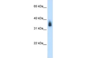Western Blotting (WB) image for anti-Melanoma Antigen Family A, 8 (MAGEA8) antibody (ABIN2462552) (MAGEA8 抗体)