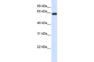Western Blotting (WB) image for anti-Solute Carrier Family 39 (Zinc Transporter), Member 4 (SLC39A4) antibody (ABIN2458809) (SLC39A4 抗体)