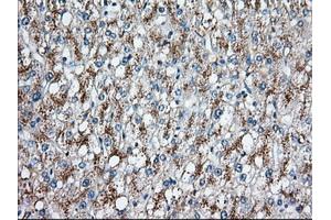 Immunohistochemical staining of paraffin-embedded Human prostate tissue using anti-C17orf28 mouse monoclonal antibody. (HID1/DMC1 抗体)