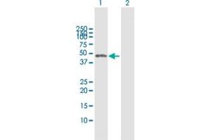 Western Blot analysis of CTBS expression in transfected 293T cell line by CTBS MaxPab polyclonal antibody. (CTBS 抗体  (AA 1-385))