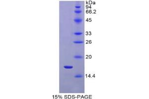 SDS-PAGE analysis of Rat IL1R1 Protein. (IL1R1 蛋白)