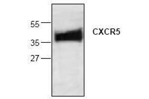 Image no. 1 for anti-Chemokine (C-X-C Motif) Receptor 5 (CXCR5) antibody (ABIN127100) (CXCR5 抗体)