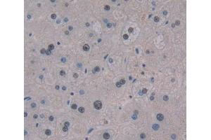Used in DAB staining on fromalin fixed paraffin- embedded liver tissue (TCEA3 抗体  (AA 59-348))