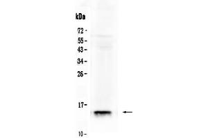 Western blot analysis of FABP2/I-FABP using anti- FABP2/I-FABP antibody . (FABP2 抗体  (AA 2-132))
