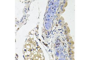 Immunohistochemistry of paraffin-embedded mouse lung using SDC2 antibody at dilution of 1:100 (x40 lens). (Syndecan 2 抗体)