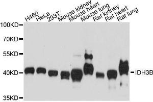 Western blot analysis of extracts of various cell lines, using IDH3B antibody. (IDH3B 抗体  (AA 35-170))