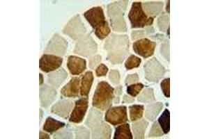 ZSWIM6 antibody (C-term) immunohistochemistry analysis in formalin fixed and paraffin embedded human skeletal muscle followed by peroxidase conjugation of the secondary antibody and DAB staining. (ZSWIM6 抗体  (C-Term))