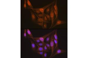 Immunofluorescence (IF) image for anti-Platelet-Activating Factor Acetylhydrolase 1b, Regulatory Subunit 1 (45kDa) (PAFAH1B1) antibody (ABIN7269401)