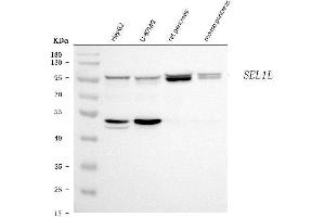 Western blot analysis of SEL1L using anti-SEL1L antibody (ABIN7599665).