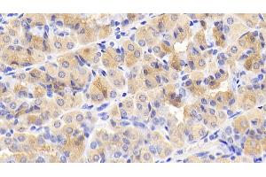 Detection of mTOR in Human Stomach Tissue using Monoclonal Antibody to Serine/threonine-protein kinase mTOR (mTOR) (MTOR 抗体  (AA 2226-2488))