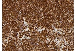 ABIN6277693 at 1/100 staining Mouse spleen tissue by IHC-P. (MECOM 抗体  (C-Term))