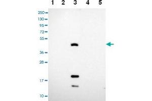 Western blot analysis of Lane 1: RT-4 Lane 2: U-251 MG Lane 3: Human Plasma Lane 4: Liver Lane 5: Tonsil with CEACAM16 polyclonal antibody . (CEACAM16 抗体)