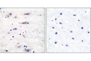 Immunohistochemistry analysis of paraffin-embedded human brain tissue, using NMDAR1 (Ab-897) Antibody.