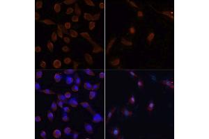 Immunofluorescence analysis of NIH/3T3 cells using MAP1LC3B antibody. (LC3B 抗体)