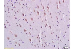 Formalin-fixed and paraffin embedded rat brain labeled with Rabbit Anti-PDGFBB Polyclonal Antibody, Unconjugated  at 1:200 followed by conjugation to the secondary antibody and DAB staining, (PDGF-BB Homodimer (AA 151-241) 抗体)