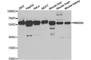 Western blot analysis of extracts of various cell lines, using RMDN3 antibody (ABIN5973434) at 1/1000 dilution. (RMDN3 抗体)