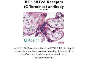 Image no. 2 for anti-5-Hydroxytryptamine (serotonin) Receptor 2A (HTR2A) (C-Term) antibody (ABIN1731361)