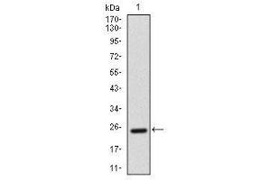 Image no. 2 for anti-Activated Leukocyte Cell Adhesion Molecule (ALCAM) antibody (ABIN1491488) (CD166 抗体)