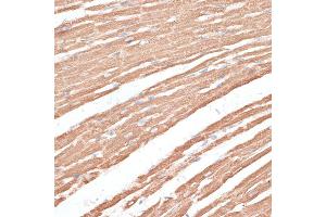 Immunohistochemistry of paraffin-embedded rat heart using KIF4A antibody (ABIN6128156, ABIN6142873, ABIN6142874 and ABIN6214349) at dilution of 1:100 (40x lens). (KIF4A 抗体  (AA 870-1080))