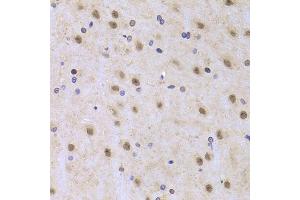 Immunohistochemistry of paraffin-embedded rat brain using ILF2 Antibody (ABIN5973487) at dilution of 1/100 (40x lens).