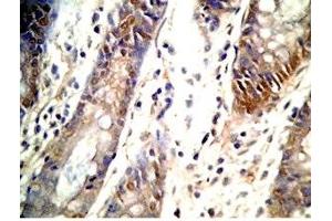 Human colon tissue was stained by Rabbit Anti-GLP-1 (2-24) (Human) Antibody (GLP-1 抗体  (AA 2-24))