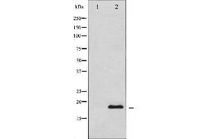 Western blot analysis of Synuclein expression in HuvEc whole cell lysates,The lane on the left is treated with the antigen-specific peptide. (SNCA 抗体  (C-Term))