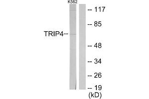 Western blot analysis of extracts from K562 cells, using TRIP4 antibody. (TRIP4 抗体  (Internal Region))