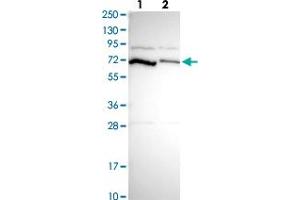 Western blot analysis of Lane 1: Human cell line RT-4 Lane 2: Human cell line U-251MG sp with PCK2 polyclonal antibody  at 1:250-1:500 dilution. (PEPCK 抗体)