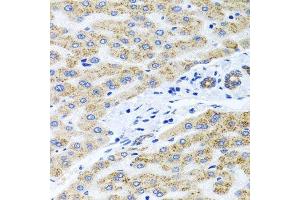 Immunohistochemistry of paraffin-embedded human liver injury using PEX14 antibody. (PEX14 抗体  (AA 118-377))