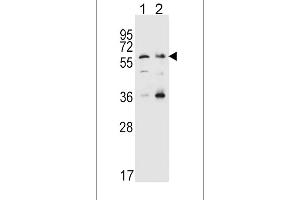 Western blot analysis in Hela(lane 1),K562(lane 2) cell line lysates (35ug/lane). (SLC22A4 抗体  (C-Term))