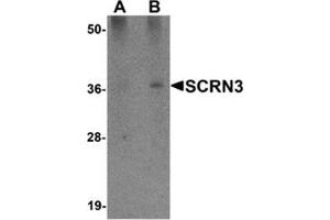 Western blot analysis of SCRN3 in 293 cell tissue lysate with SCRN3 antibody at (A) 1 and (B) 2 μg/ml. (Secernin 3 抗体  (Center))