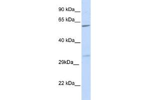 WB Suggested Anti-PRPS2 Antibody Titration:  0. (PRPS2 抗体  (N-Term))