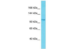 Host: Rabbit Target Name: SKIDA1 Sample Type: Jurkat Whole Cell lysates Antibody Dilution: 1. (SKIDA1 抗体  (C-Term))