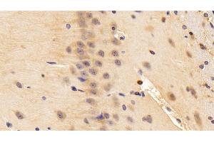 Detection of NGF in Rat Cerebrum Tissue using Polyclonal Antibody to Nerve Growth Factor (NGF) (Nerve Growth Factor 抗体  (AA 19-241))