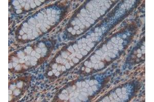 DAB staining on IHC-P; Samples: Human Rectum Tissue (CRAF 抗体  (AA 342-619))