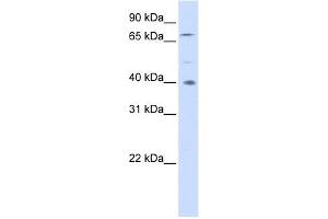 SPATA7 antibody used at 1 ug/ml to detect target protein. (SPATA7 抗体  (Middle Region))