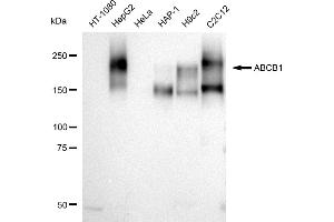 Western blotting analysis using ABCB1 antibody (ABIN7797683).