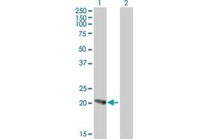 Western Blot analysis of PFDN5 expression in transfected 293T cell line by PFDN5 MaxPab polyclonal antibody. (PFDN5 抗体  (AA 1-154))