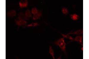 ABIN6275245 staining HeLa by IF/ICC. (MRPL49 抗体  (Internal Region))