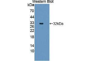 Detection of Recombinant CTNNa1, Human using Polyclonal Antibody to Catenin Alpha 1 (CTNNa1) (CTNNA1 抗体  (AA 2-228))