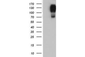HEK293T cells were transfected with the pCMV6-ENTRY control (Left lane) or pCMV6-ENTRY ENPEP (Right lane) cDNA for 48 hrs and lysed. (ENPEP 抗体)