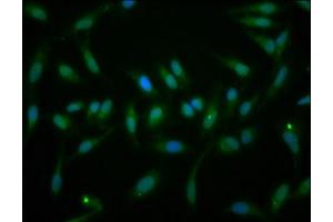Immunofluorescence staining of Hela cells with ABIN7152355 at 1:166, counter-stained with DAPI. (EYA1 抗体  (AA 168-321))