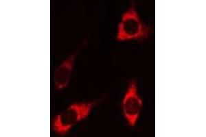 ABIN6269202 staining HEK 293 cells by IF/ICC. (PI3K p85 alpha/gamma 抗体)