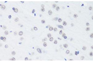 Immunohistochemistry of paraffin-embedded Rat brain using TriMethyl-Histone H3-K64 Polyclonal Antibody at dilution of 1:100 (40x lens). (Histone 3 抗体  (3meLys64))