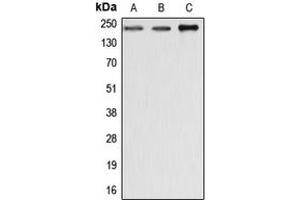Western blot analysis of Dysferlin expression in MCF7 (A), SP2/0 (B), rat liver (C) whole cell lysates. (Dysferlin 抗体  (C-Term))