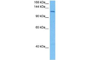 Host:  Mouse  Target Name:  SMC3  Sample Tissue:  Mouse Liver  Antibody Dilution:  1ug/ml (SMC3 抗体  (N-Term))