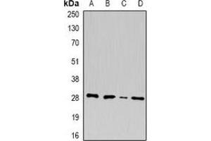 Western blot analysis of U2AF1 expression in A549 (A), MCF7 (B), mouse pancreas (C), rat liver (D) whole cell lysates. (U2AF1 抗体)
