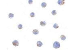 Immunocytochemistry of BIK in Jurkat cells with AP30150PU-N BIK antibody at 1 μg/ml. (BIK 抗体  (N-Term))