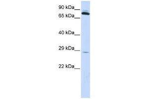TPK1 antibody used at 1 ug/ml to detect target protein. (TPK1 抗体  (N-Term))